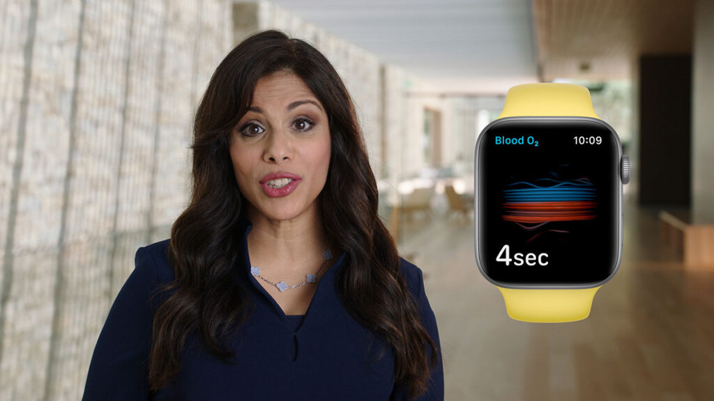 Apple Sumbal Watch orologio smart smartwatch